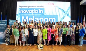 imagine Melanom Romania jpg