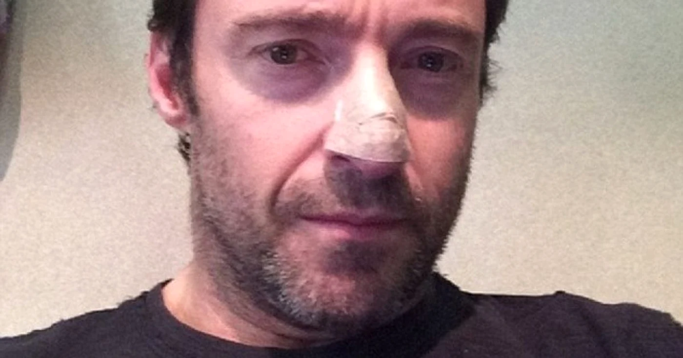 Jackman (45 de ani) atrage atenţia asupra cancerului de piele. FOTO Instagram/ Reuters