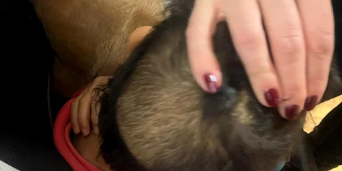 copil rămas fără păr de la poziția aproape permanentă pe spate într un pătuț foto georgiana pascu png