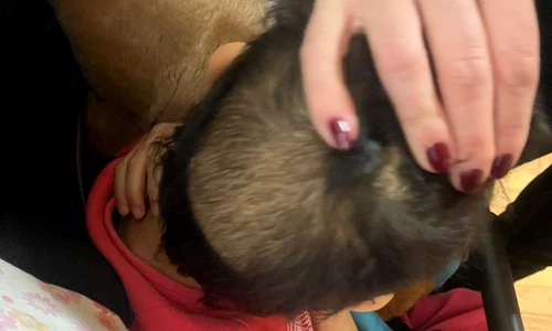 copil rămas fără păr de la poziția aproape permanentă pe spate într un pătuț foto georgiana pascu png