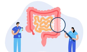 Test pentru depistarea precoce a cancerului colorectal  Sursa foto shutterstock 1841493067 jpg