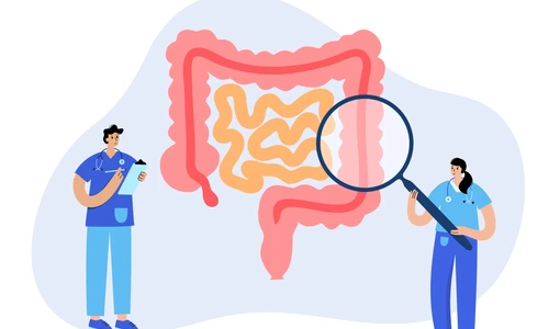 Test pentru depistarea precoce a cancerului colorectal  Sursa foto shutterstock 1841493067 jpg