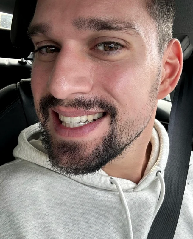 Vlad Gherman poartă aparat dentar invizibil Foto: Arhivă personală 