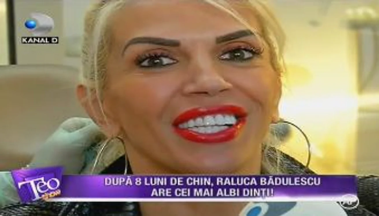 Raluca Bădulescu a îndurat 8 luni de vizite la dentist