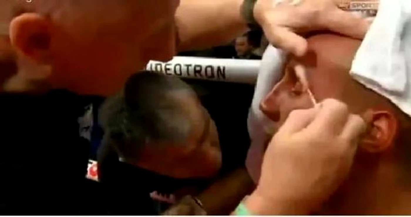 James DeGale arcada sangereaza