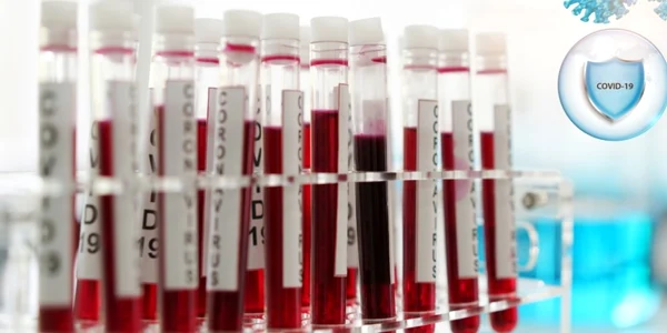 titru test anticorpi Foto Synevo. jpg