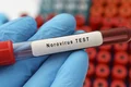 norovirus timisoara getty jpg
