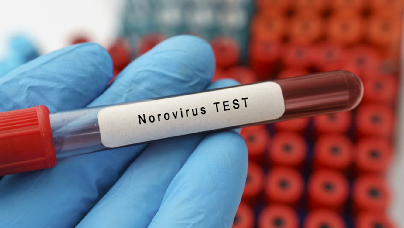 foto eprubetă test pentru norovirus