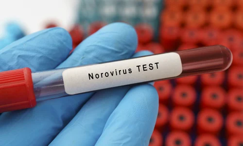 norovirus timisoara getty jpg