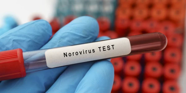 norovirus timisoara getty jpg