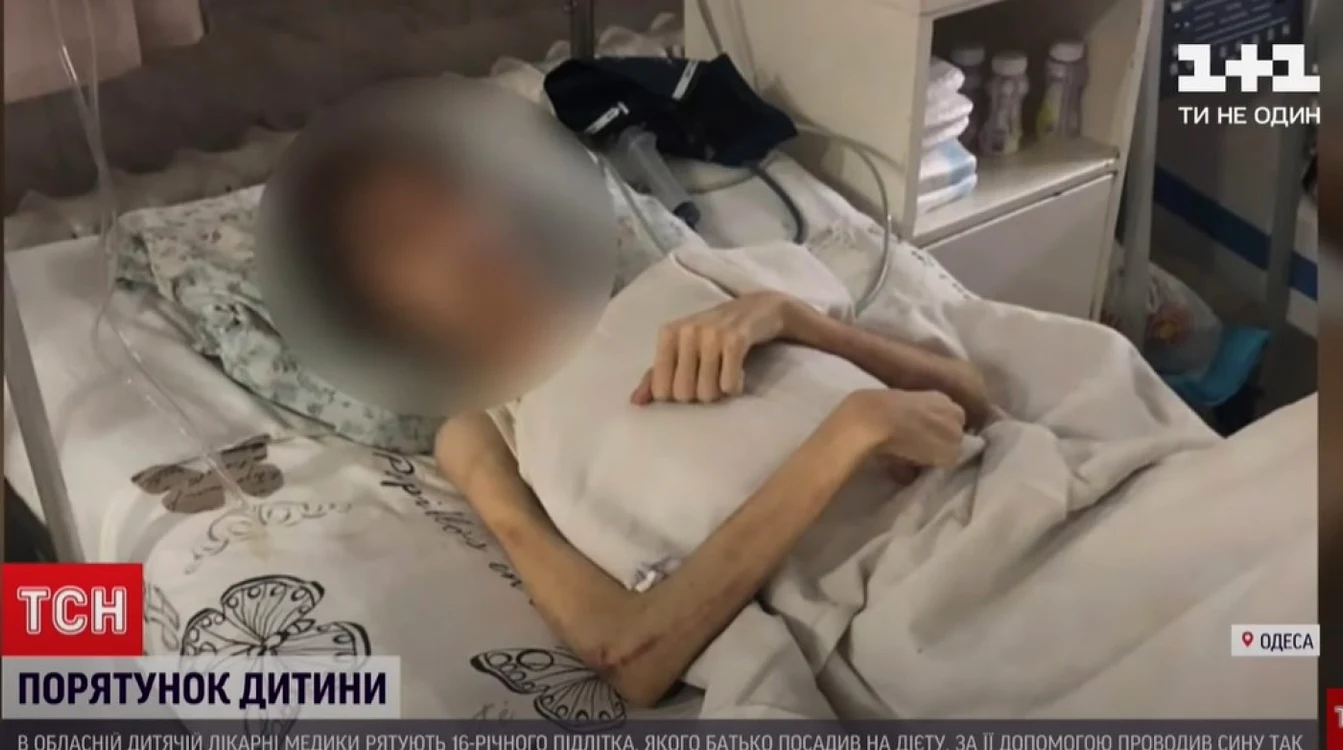 Băiatul în vârstă de 16 ani cântăreşte mai puţin de 30 de kilograme, la o înălţime de 180 cm
