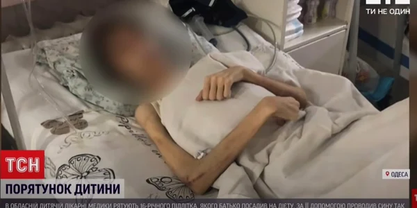 Copil Subnutrit Odessa