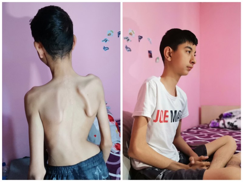 Drama adolescentului al cărui corp a luat-o razna. Imploră să fie ajutat: „Vreau să mă fac bine, să merg la școală”