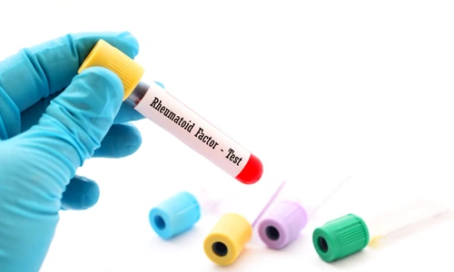 factor reumatoid jpg