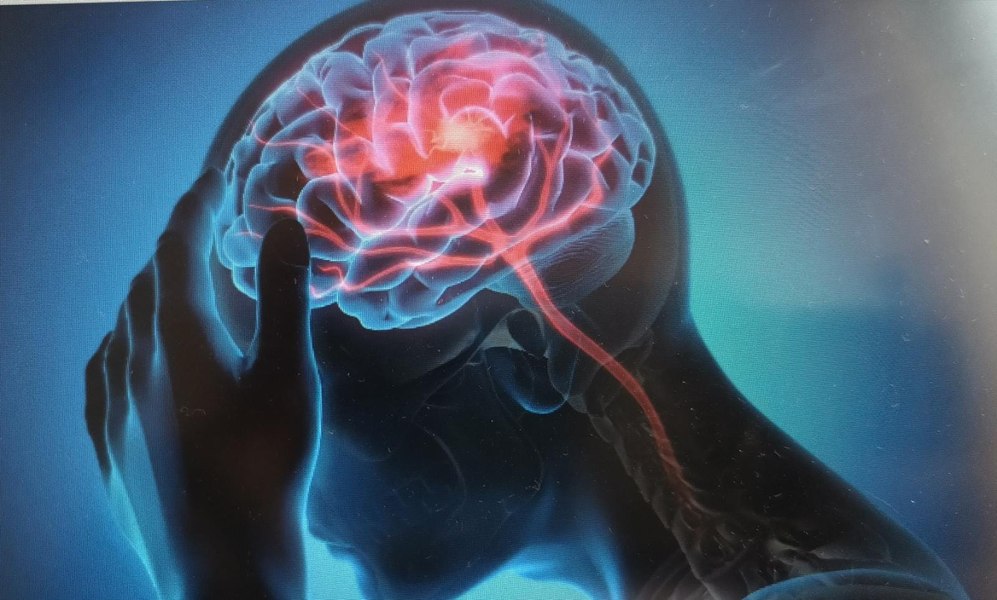 Care este tratamentul optim pentru accidentele vasculare cerebrale. Un nou studiu aduce clarificări importante