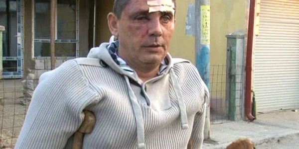 Bărbatul jefuit. Foto Alex Policală
