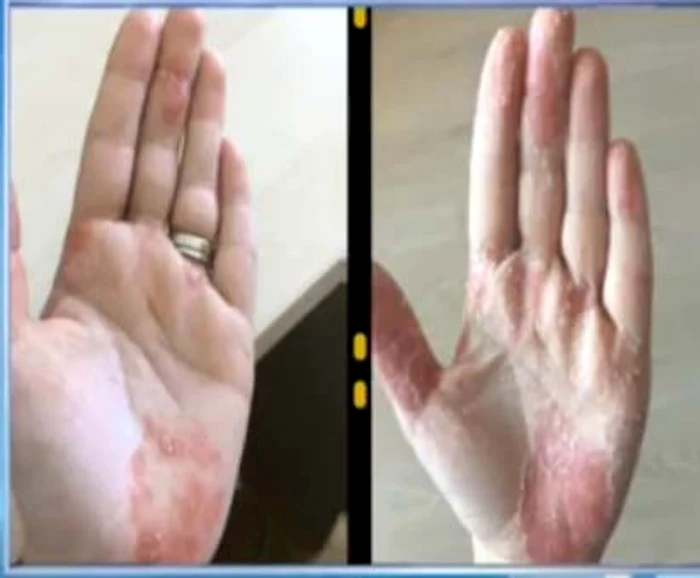 Aşa arată mâinile lui Tili Niculae 