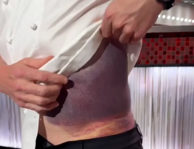 Gordon Ramsay, la un pas de moarte, după un accident de bicicleta FOTO: Captura video
