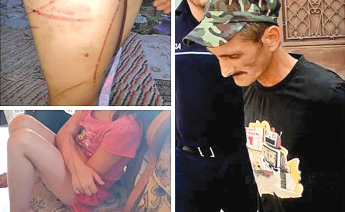 
    Urmele lăsate de bici pe trupul copilelor   