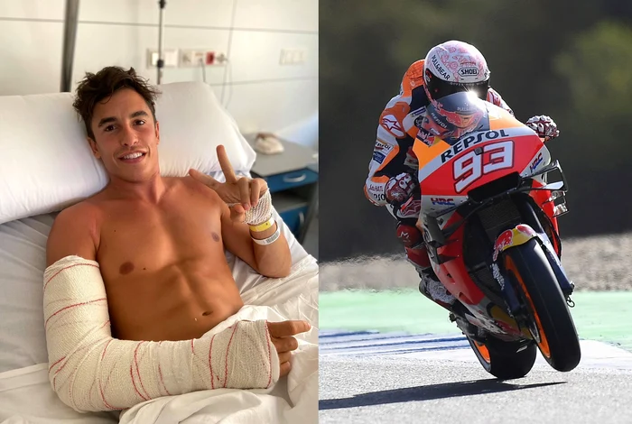 
    Marc Marquez vrea să revină pe circuitul din Jerez la nicio săptămână după ce și-a fracturat brațul dreptFoto: Guliver / GettyImages  