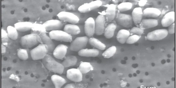Bacteriile dezvoltate într-un mediu cu arsenic