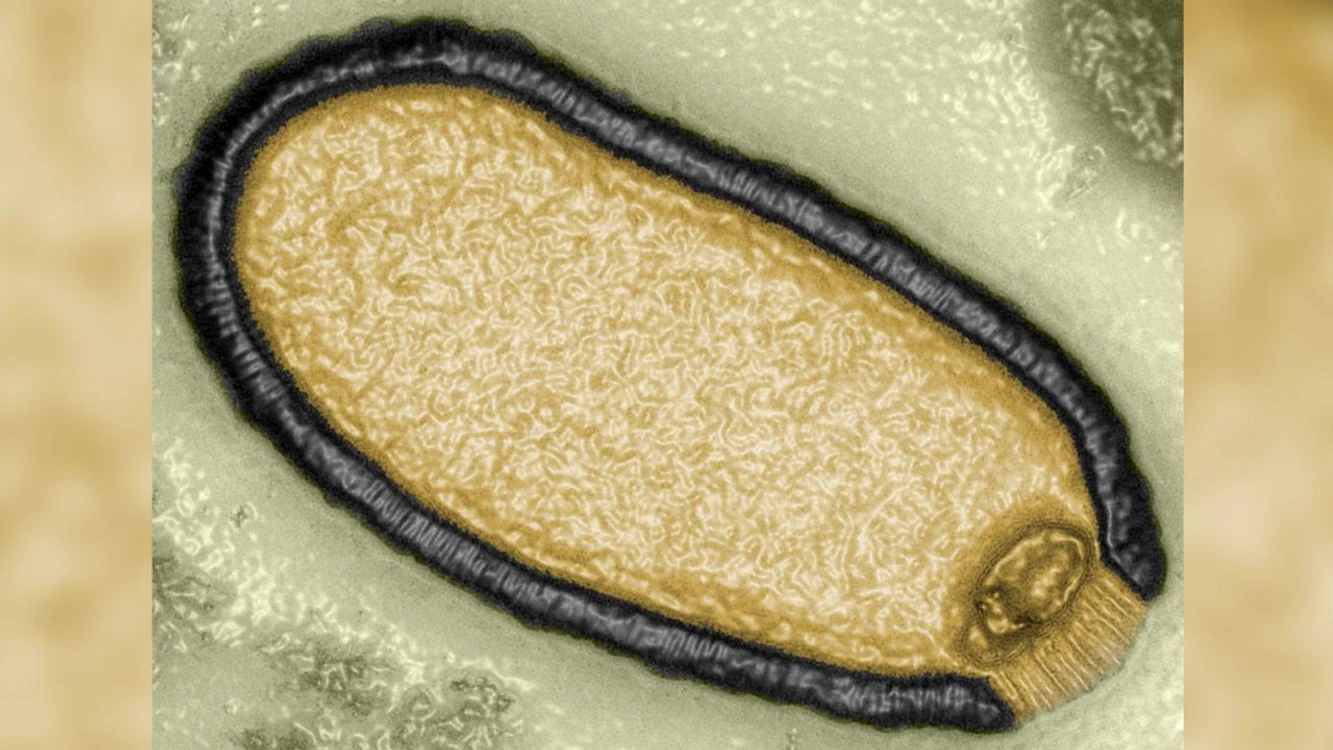 Pithovirus sibericum. FOTO Jean-Michel Claverie/IGS/CNRS-AMU Sursă CNN