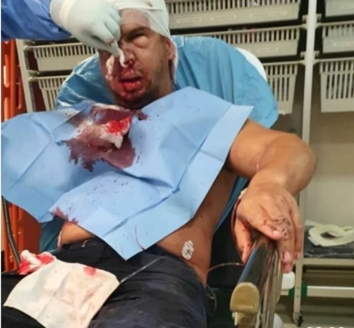 Așa arăta Călin Pană după atactul mafiot din Chiajna, în timp ce i se acordau primele îngrijiri în ambulanță