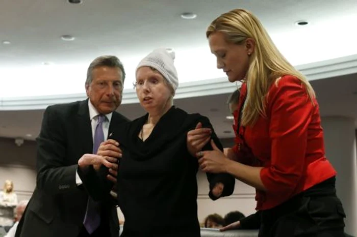 Charla Nash (FOTO REUTERS)