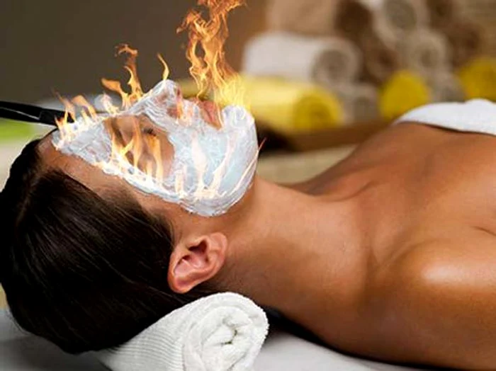 Cele mai ciudate tratamente pentru frumuseţe: Tratamentul facial prin foc - ajută la reducerea ridurilor foto: apropotv.ro