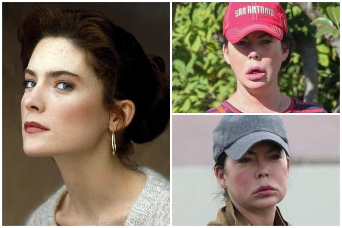 1 lana flynn boyle before after 1170x780 jpg jpeg