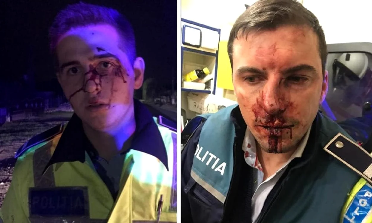 
    Polițiștii bătuți s-au ales cu traumatisme cranio-faciale, fractură de piramidă nazală și de arcadă Foto: Sindicatul Europol  