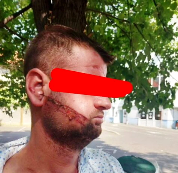 Unul dintre tineri cade lat după ce încasează o ulucă în zona capului. FOTO cronica-gaestiului.ro