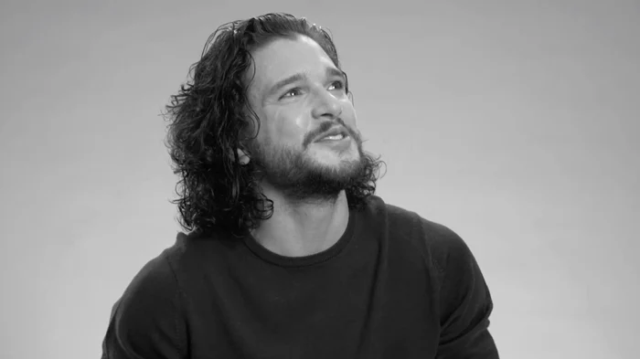 How black eye may have got me Game of Thrones role by Jon Snow s jpeg