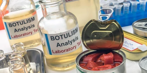 botulism Sursă foto: Profimedia