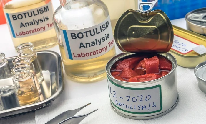 botulism Sursă foto: Profimedia