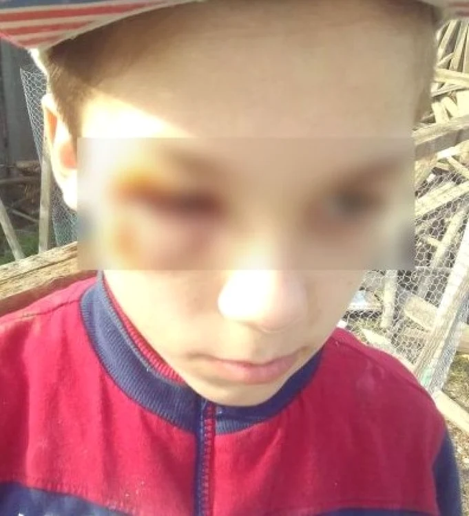 Copilul a fost găsit de poliţişti plin de vânătăi FOTO Adevărul