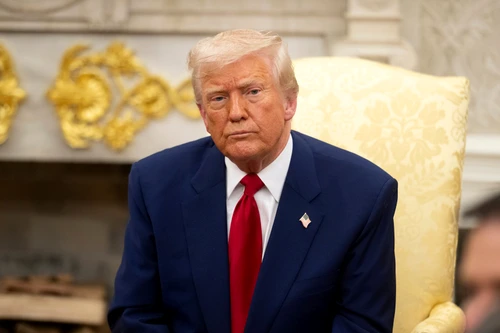 Ce este insuficiența venoasă cronică de care suferă Donal Trump și ce impact are?
