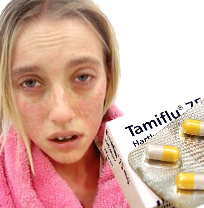 
    Tânăra de 19 ani a rămas desfigurată după ce a luat trei pastile de Tamiflu  
