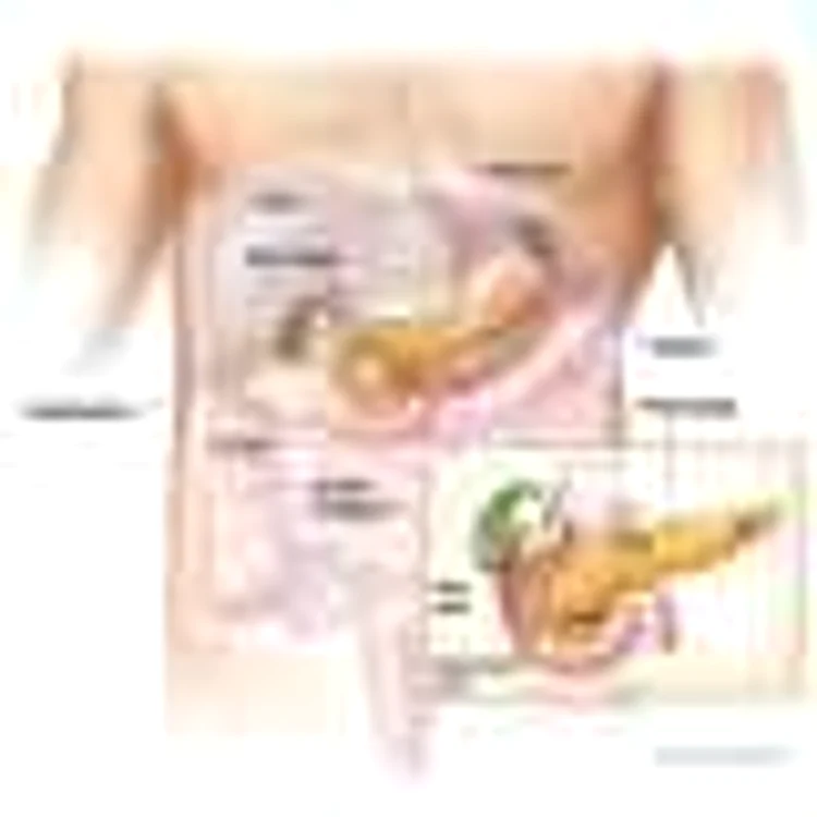 Grafica - cavitate abdominala