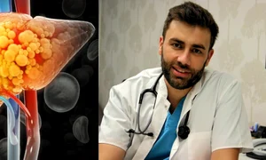 Doctorul Marius Sava ofera solutiile pentru tratamentul ficatului gras, foto Facebook, Shutterstock jpg