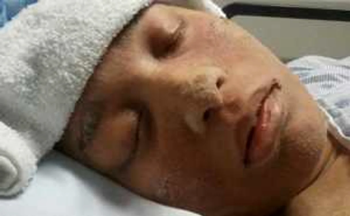 Corpul Shanyei Isom este acoperit în întregime de mici  excrescenţe cornoase, asemănătoare unghiilor
