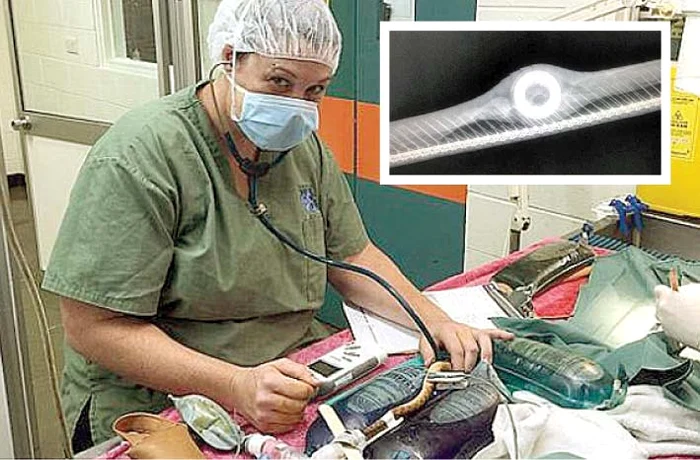 Medicul i-a scos obiectul care l-ar fi ucis
