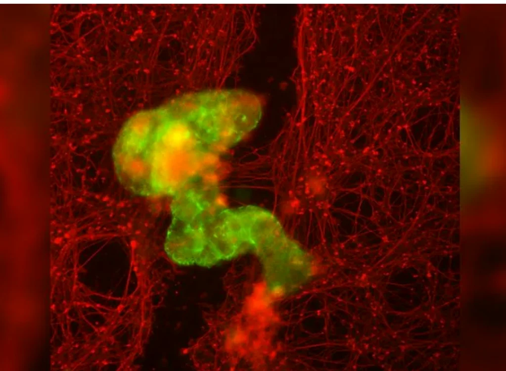 Un antrobot crește printr-o zgârietură prin țesutul neuronal. FOTO Gizem Gumuskaya, Tufts University