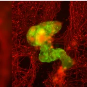 antrobot Un antrobot, în verde, crește printr o zgârietură prin țesutul neuronal, în roșu    Gizem Gumuskaya, Universitatea Tufts png
