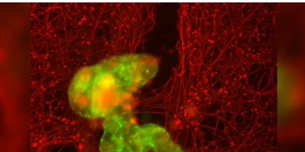 antrobot Un antrobot, în verde, crește printr o zgârietură prin țesutul neuronal, în roșu    Gizem Gumuskaya, Universitatea Tufts png