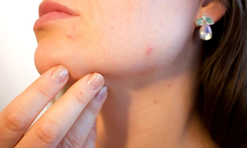 cele mai contagioase boli de piele jpeg