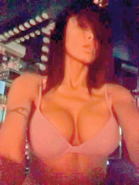 Oana Zăvoranu și-a pus implanturi de 460 ml