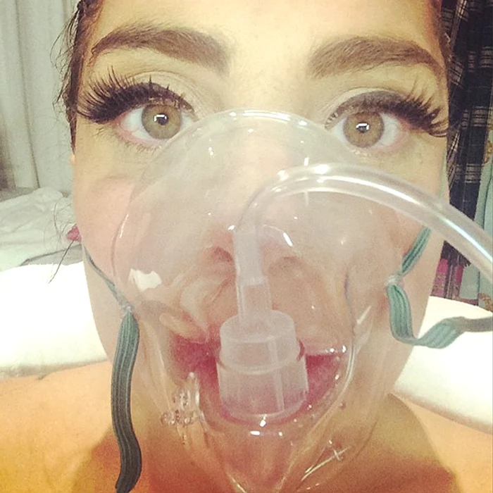 
    Lady Gaga a trebuit să poarte o mască de oxigenFoto: Instagram  