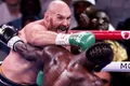 Tyson Fury, EPA jpg