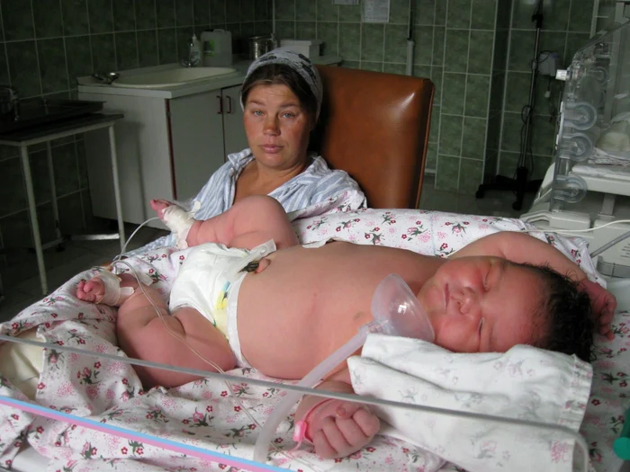 Botoşani: Gigantul a venit pe lume anul trecut şi avea 6800 grame